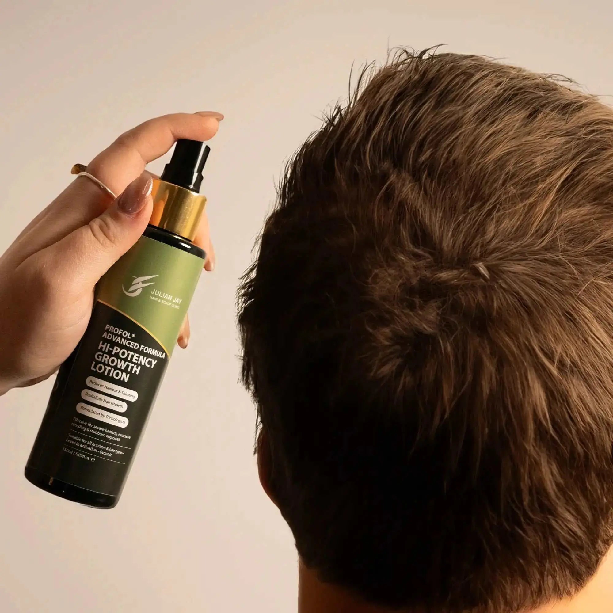 Advanced Hair Growth Lotion for Severe Hair Loss & Thinning HairLotion SprayAdvanced Hair Growth Lotion