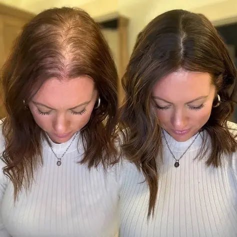 10 hair loss mistakes to avoid to enhance your treatment's effectiveness. - Julian Jay Hair Care