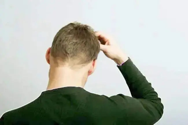 Dandruff and Scalp Psoriasis Treatment - Julian Jay Hair Care