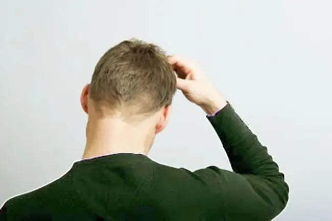 Dandruff and Scalp Psoriasis Treatment - Julian Jay Hair Care