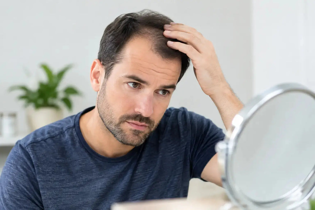 Androgenetic Alopecia Guide for Thinning Hair
