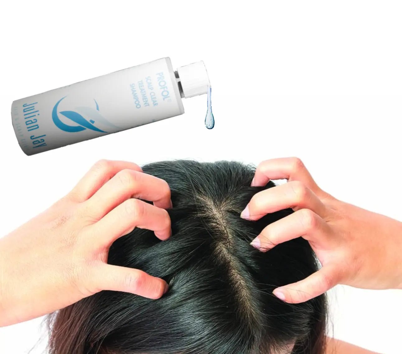 Female hair loss: Understanding the causes and treatments - Julian Jay Hair Care