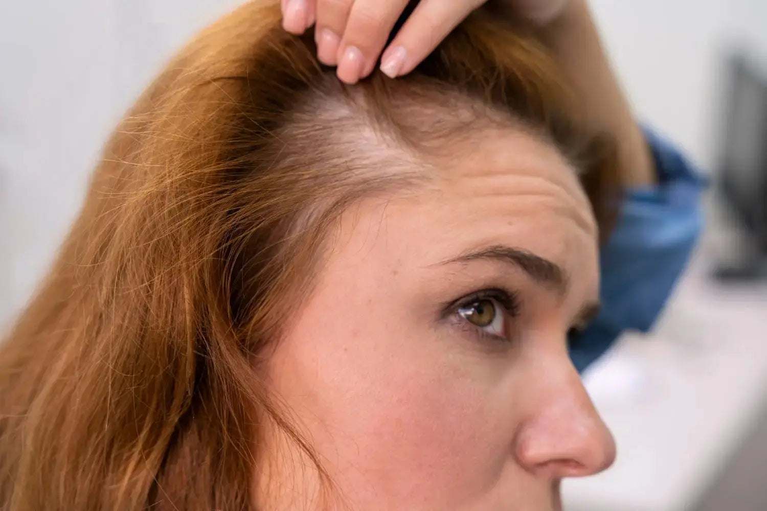 Hair Loss! Can I blame  Genetics? - Julian Jay Hair Care