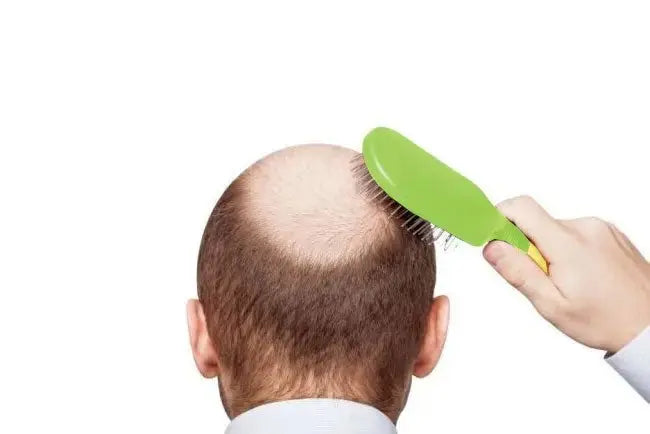 Hair Loss Causes - Julian Jay Hair Care