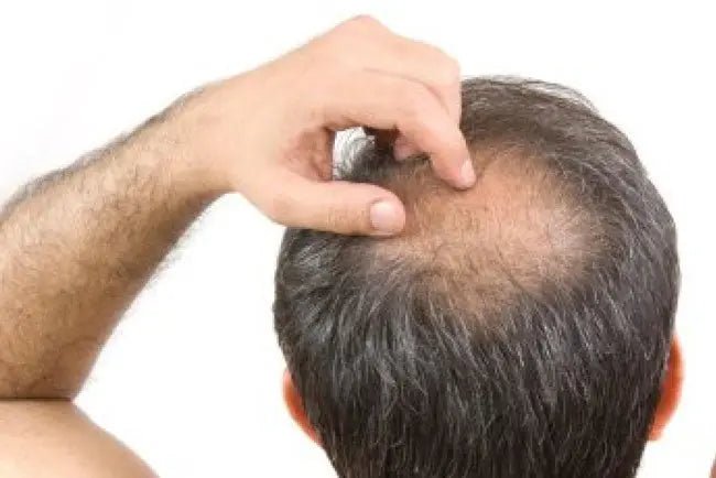 Hair Loss Fact & Fiction - Julian Jay Hair Care