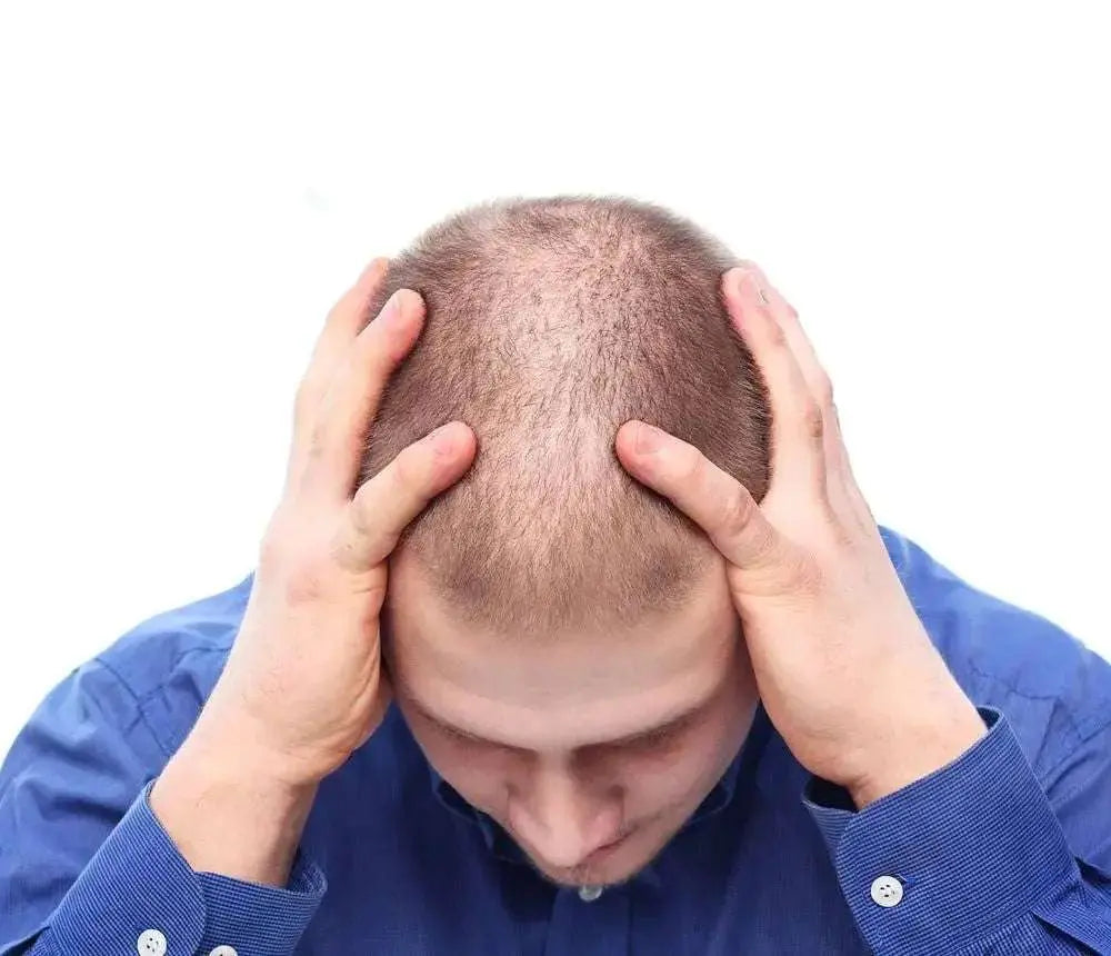 Hair Loss Treatments That Work - Julian Jay Hair Care
