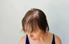 Is my hair really thinning or is it just paranoia? - Julian Jay Hair Care