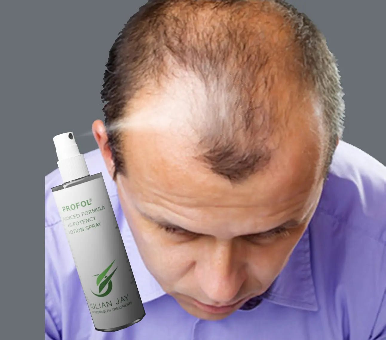 Is Profol Advanced Formula hair regrowth Lotion more effective than Minoxidil Topical Lotion - Julian Jay Hair Care