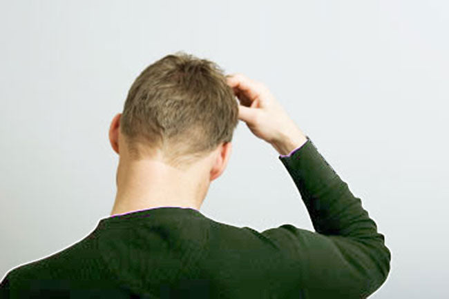 Dandruff and Scalp Psoriasis Treatment