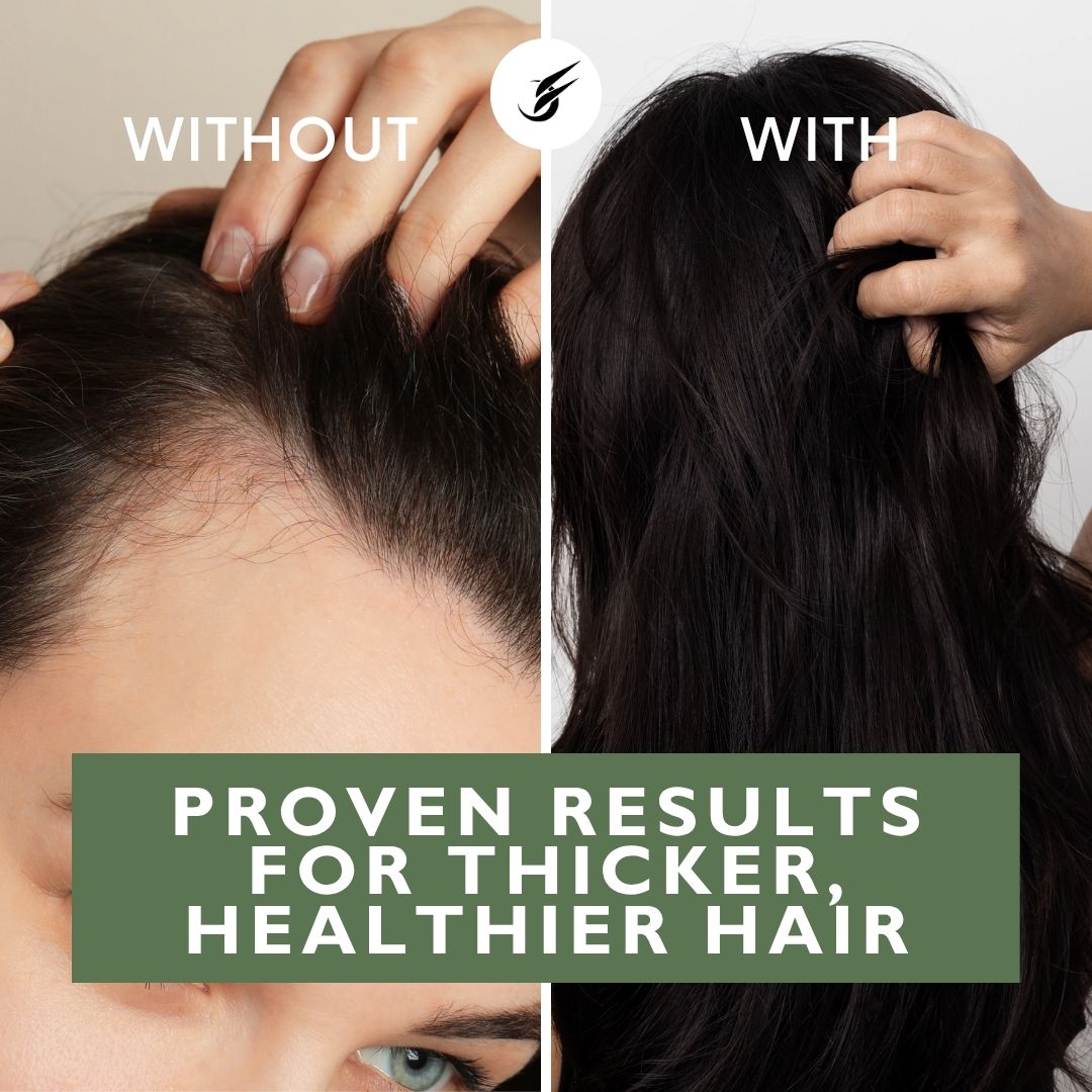 Individuals Suffering Hair Loss