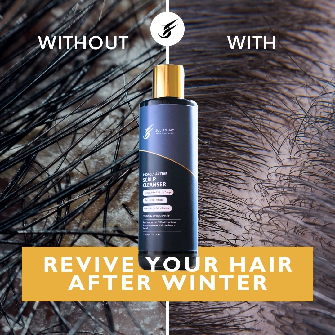 Scalp Cleanser for Anti Dandruff &amp; Anti itch hair. Julian Jay - Julian Jay Hair Care