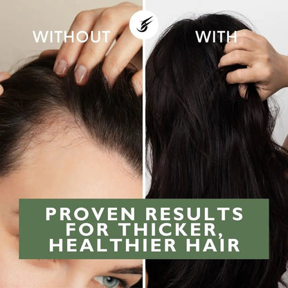 Advanced Formula Hi - Potency Growth Lotion - Julian Jay Hair Care